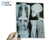 فیلم * 10 * 12 اینچ PET تصویربرداری پزشکی فیلم X-Ray خشک برای چاپگرهای جوهر افشان