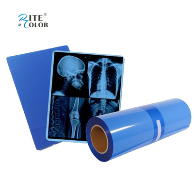 IMATEC Blue PET Inkjet Medical CR فیلم رادیوگرافی اشعه ایکس برای چاپگرهای کانن