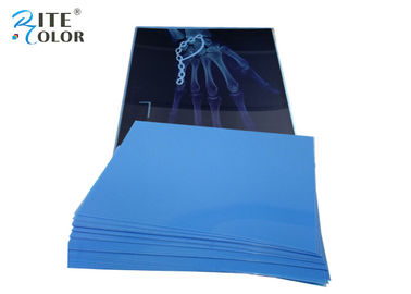 فیلم * 10 * 12 اینچ PET تصویربرداری پزشکی فیلم X-Ray خشک برای چاپگرهای جوهر افشان