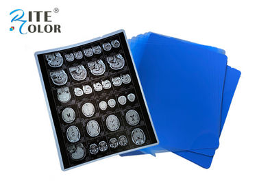 فیلم PET Base X Ray Sheets Film Radiology برای DR CT 100 برگه در هر بسته
