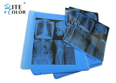 فیلم رادیولوژی ، تصویربرداری پزشکی X X ray ، ضخامت 210um برای پرینتر جوهر افشان Epson