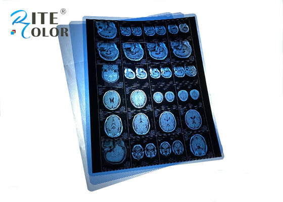 پنروک PET آبی فیلمی ایکس اشعه پزشکی برای MRI CT CR
